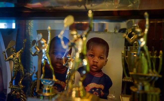 球后的干拔 球后的干拔